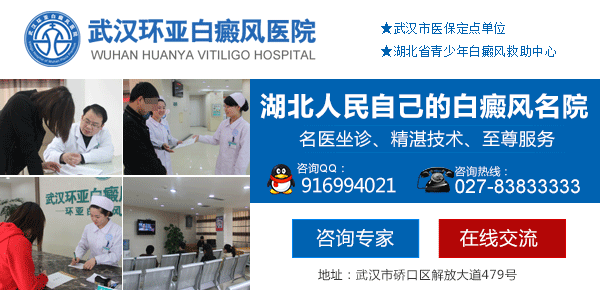 武汉白癜风哪里能治