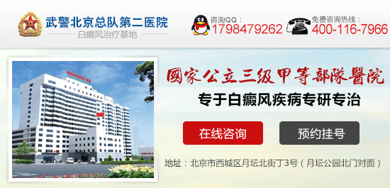 北京哪家医院能治白癜风 北京哪家医院能治白癜风