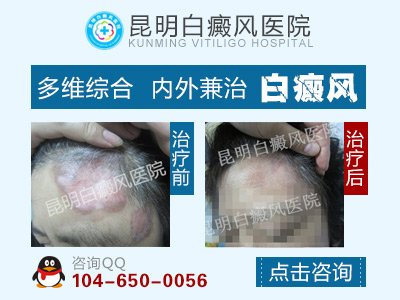 �������������ܼ��